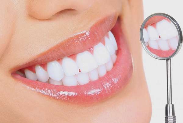 Phương pháp dán sứ thẩm mỹ Veneers