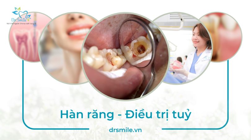 Kháng Sinh Răng Rodogyl: Công Dụng, Liều Lượng và Hướng Dẫn Sử Dụng Hiệu Quả