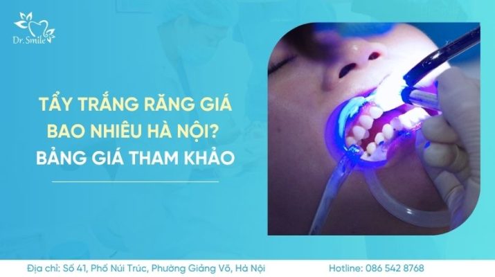 tẩy trắng răng giá bao nhiêu Hà Nội