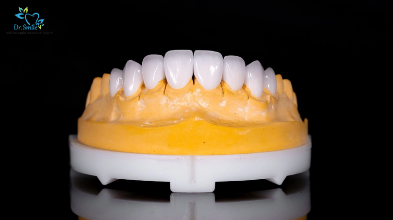 Cách chăm sóc răng sứ luôn giữ được độ trắng tự nhiên
