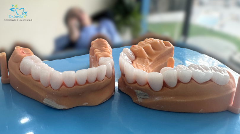 Răng sứ zirconia có cấu tạo như thế nào