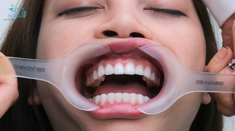 nha khoa uy tín Hà Nội gần đây