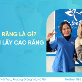 Lấy cao răng