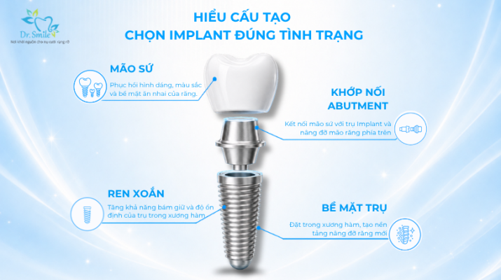 Cấu tạo implant