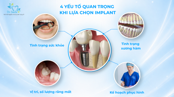 Lựa chọn implant phù hợp để tránh những rủi ro