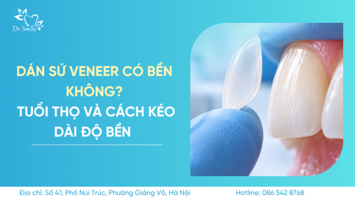 dán sứ veneer có bền không