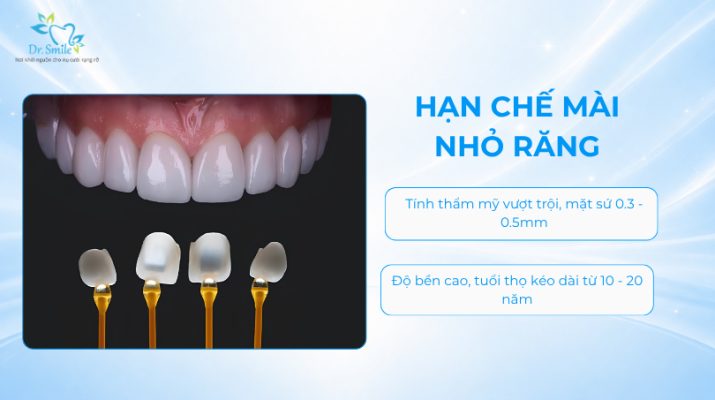 Dán sứ Veneer siêu mỏng là gì?