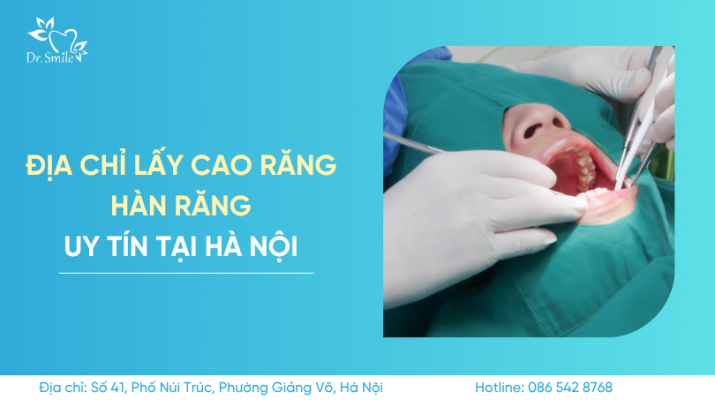 địa chỉ lấy cao răng hàn răng uy tín tại hà nội