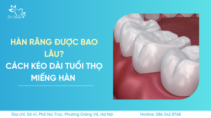 hàn răng được bao lâu