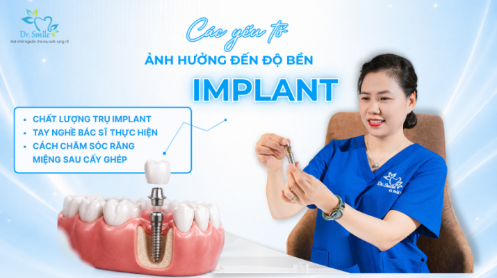 Các yếu tố ảnh hưởng đến độ bền của Implant