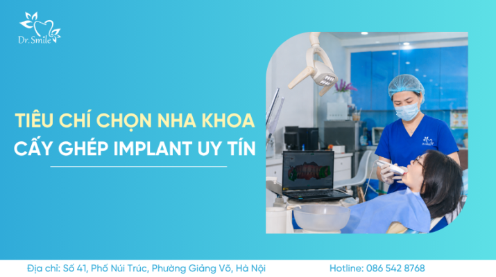 nha khoa cấy ghép implant uy tín