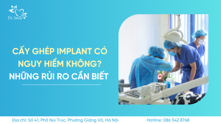 quy trình cấy ghép implant