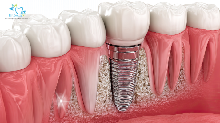 Xây dựng kế hoạch điều trị phù hợp