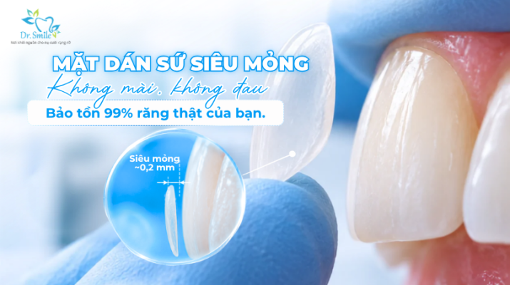 Bảo tồn tối đa răng thật