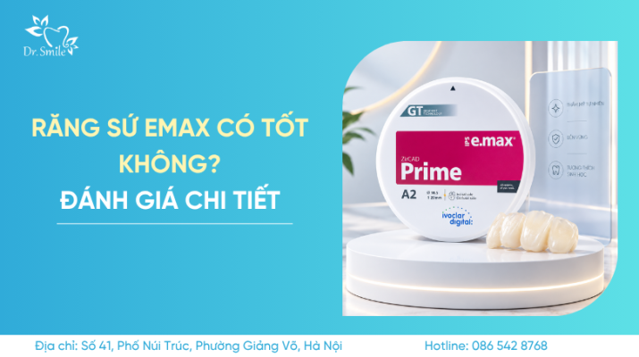 răng sứ emax có tốt không